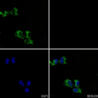 3 - Anti-CACNG1 Antibody AP51881