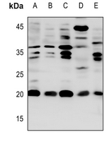 1 - Anti-CACNG1 Antibody AP51881