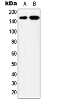 1 - Anti-YEATS2 Antibody AP51882