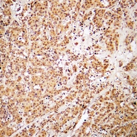 19 - Anti-ZNF50 Antibody AP51883