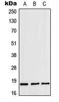 1 - Anti-ZNHIT1 Antibody AP51884
