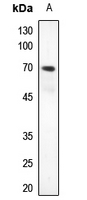 1 - Anti-ZNF460 Antibody AP51885
