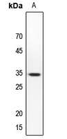 1 - Anti-SMUG1 Antibody AP51894