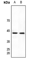 1 - Anti-HEXIM2 Antibody AP51895