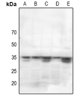 1 - Anti-STARD10 Antibody AP51898