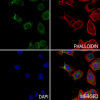 3 - Anti-IL-22RA2 Antibody AP51901