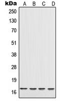 1 - Anti-IL-17 Antibody AP51903