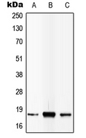 1 - Anti-IL-4 Antibody AP51905