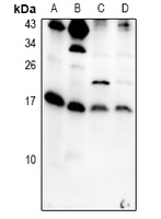 1 - Anti-IL-5 Antibody AP51906
