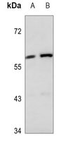 1 - Anti-Cytokeratin 84 Antibody AP51907