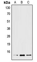 1 - Anti-XCL2 Antibody AP51911