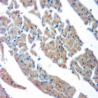19 - Anti-Cytochrome P450 2C9 Antibody AP51913