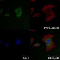 3 - Anti-Cytochrome P450 2D6 Antibody AP51914