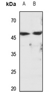 1 - Anti-Cytochrome P450 2D6 Antibody AP51914