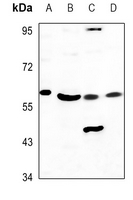 1 - Anti-Cytochrome P450 3A7 Antibody AP51915