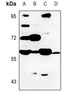 1 - Anti-Cytochrome P450 8B1 Antibody AP51917