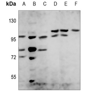 1 - Anti-PI3K p85 beta Antibody AP51918