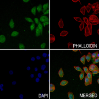 3 - Anti-HIPK2 Antibody AP51919
