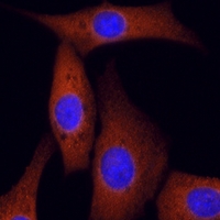 3 - Anti-ROCK2 Antibody AP51921