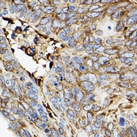 19 - Anti-ROCK2 Antibody AP51921