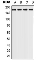 1 - Anti-ROCK2 Antibody AP51921