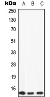 1 - Anti-Apolipoprotein C2 Antibody AP51924