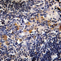 19 - Anti-Microcephalin Antibody AP51933