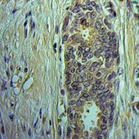 19 - Anti-Midkine Antibody AP51934