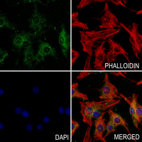 3 - Anti-CD156c Antibody AP51935