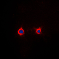 3 - Anti-Adenosine A2a Receptor Antibody AP51941