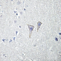 19 - Anti-Adenosine A2a Receptor Antibody AP51941