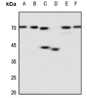 1 - Anti-Adenosine A2a Receptor Antibody AP51941