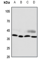 1 - Anti-CCRL2 Antibody AP51943