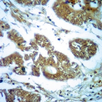 19 - Anti-Dopamine Receptor D1 Antibody AP51944