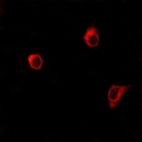 3 - Anti-Frizzled 6 Antibody AP51945