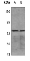 1 - Anti-Frizzled 6 Antibody AP51945