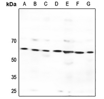 1 - Anti-GPR176 Antibody AP51946