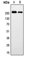 1 - Anti-GPR179 Antibody AP51954