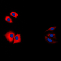 3 - Anti-Caspase 1 p10 Antibody AP51962