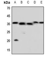 1 - Anti-Caspase 5 p10 Antibody AP51964