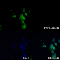 3 - Anti-ITIHC2 Antibody AP51965
