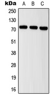 1 - Anti-ITIHC2 Antibody AP51965