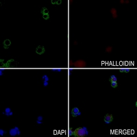 3 - Anti-Nav1.6 Antibody AP51970
