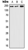 1 - Anti-Nav1.6 Antibody AP51970