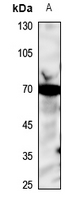 1 - Anti-Acid Sphingomyelinase Antibody AP51974