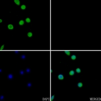 3 - Anti-ECA39 Antibody AP51975