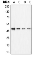 1 - Anti-ECA39 Antibody AP51975