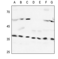 1 - Anti-Heme Oxygenase 2 Antibody AP51976