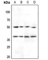 1 - Anti-Inhibin beta A Antibody AP51977