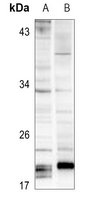 1 - Anti-SOCS3 Antibody AP51979